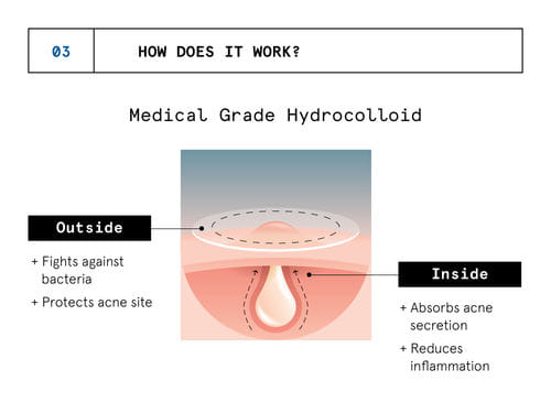Hydrocolloid Acne Pimple Patch