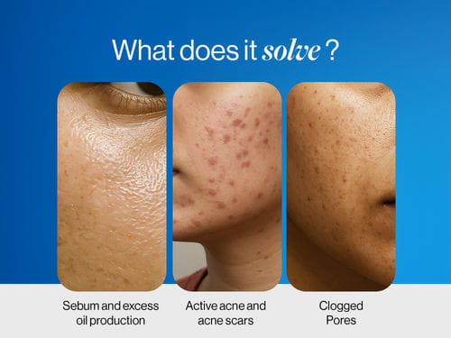 2% Salicylic Acid Face Wash