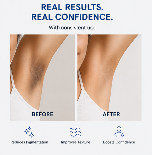 Be Bodywise 4% AHA BHA Underarm Roll-On for Even Tone Skin, 2% Lactic, 1% Mandelic and 1% Salicylic Acid, Controls Odour & Reduces Pigmentation, 0% Alcohol & 0% Aluminium, Flora Fragrance, 50ml
