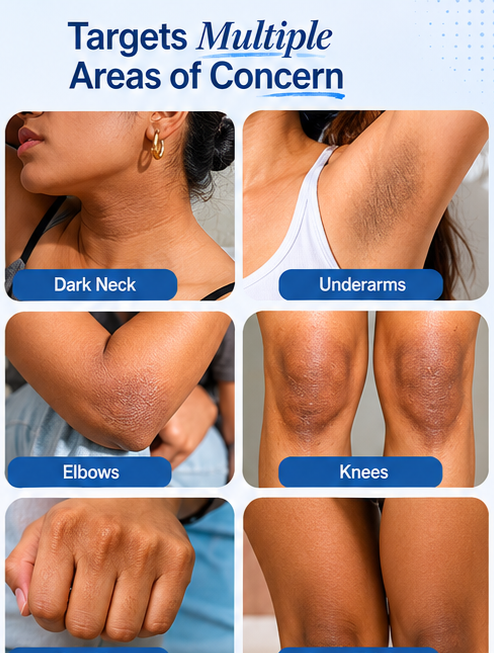 Be Bodywise Pigmentation Cream 100gm | 2.5% Lactic Acid, 2% Urea, Retinol & Kojic Acid | Reduces Tan, Pigmentation & Evens Skin Tone | Treats Dark Patches & Rough Skin on Elbows, Knees, Back of Neck & Thighs | For Daily Use
