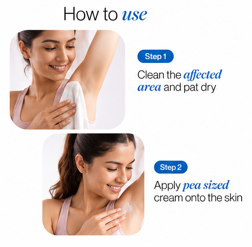 Be Bodywise Pigmentation Cream 100gm | 2.5% Lactic Acid, 2% Urea, Retinol & Kojic Acid | Reduces Tan, Pigmentation & Evens Skin Tone | Treats Dark Patches & Rough Skin on Elbows, Knees, Back of Neck & Thighs | For Daily Use